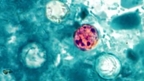Diarrhea-causing parasite that can contaminate raw produce causing misery across several states