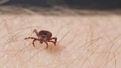 ‘My fingers were purple’: Tick-borne disease nearly killed a Canadian man