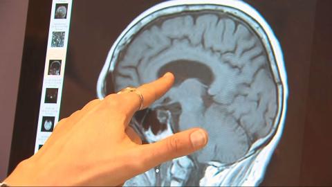 Up to 45% of dementia risk can be prevented, delayed: WHO