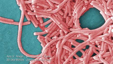 Outaouais public health unit investigating cases of Legionnaires’ disease in Aylmer, Que.