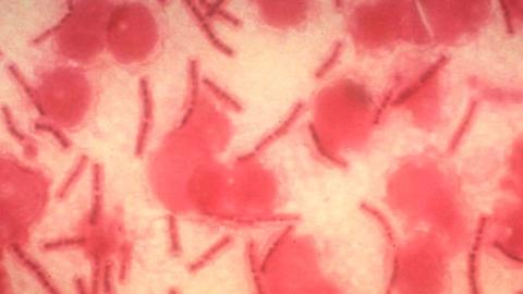 AI can fuel biological weapons. We must harness its power for defense