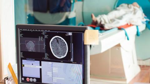 Albertans can pay for MRIs and other tests without a doctor's referral, as of Friday
