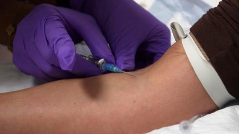 Peptides are rising in popularity, but health experts warn ‘very few of them’ have any benefits