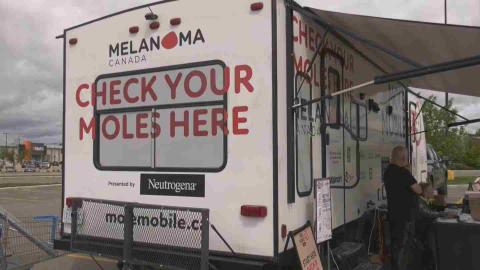 Mole Mobile brings free skin cancer screenings to Nova Scotia, New Brunswick