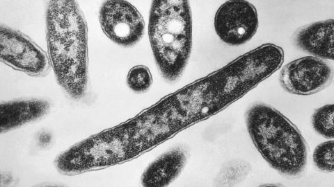 New York City Legionnaires’ disease outbreak linked to 7 deaths is declared over