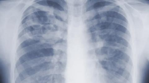 Are you underestimating mold-related illness? What U.S. study says
