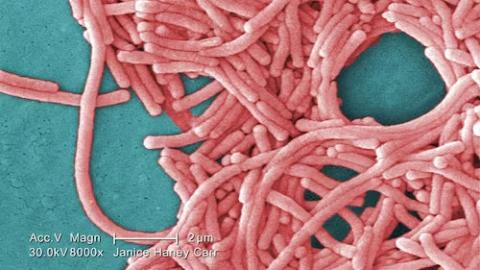 Legionnaires’ disease outbreak near downtown Toronto under investigation