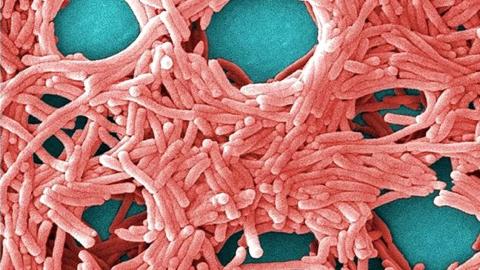 Legionnaires' disease causes and symptoms as health officials investigate Toronto outbreak