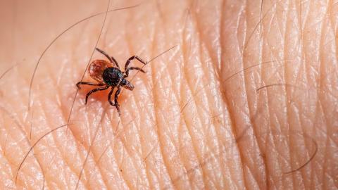 There’s a tick-borne disease on the rise that’s even worse than Lyme