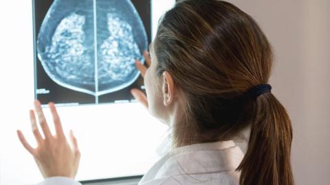 AI can detect heart disease in women using mammograms, study suggests