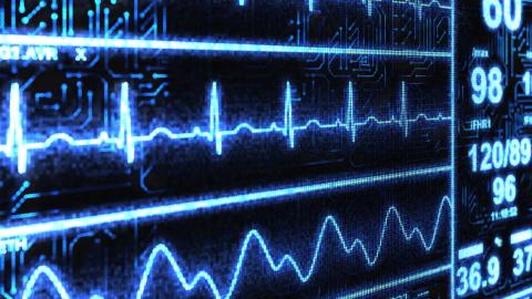 ‘Superhuman’ AI tool spots heart disease in less than 2 seconds