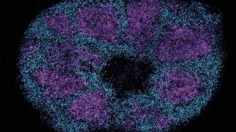Scientists map key protein interactions linked with profound autism