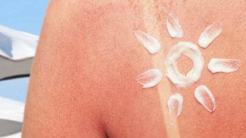 No safe tan: Why Canada’s sunburn problem keeps getting worse