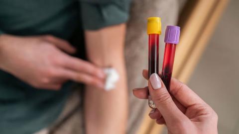 Routine blood testing may hold hidden clues to colorectal cancer before age 45