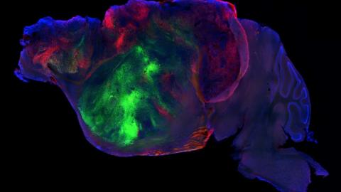 Mice with human brain cells offer a tool to study disease. Ethicists ask: What's next?
