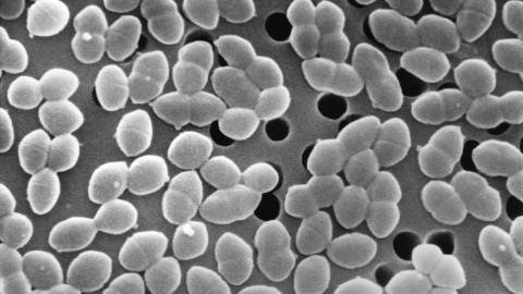Eating sugar while taking antibiotics might harm gut bacteria
