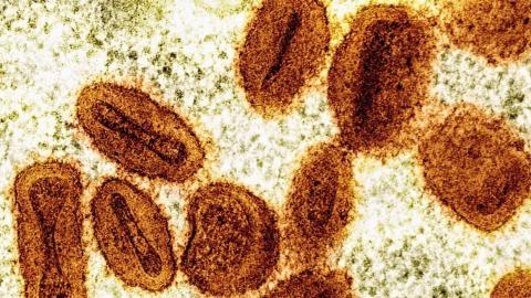 2 scientists charged with bringing deactivated mpox virus into U.S., lying to authorities