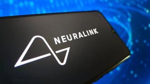 2 Toronto hospital patients get Elon Musk's Neuralink implants