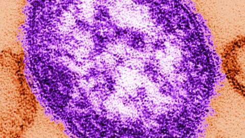 Ottawa Public Health alerting residents of possible measles exposure locations