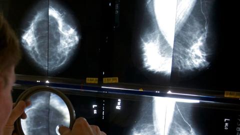 Breast cancer conference slammed for photo showing all-male panel