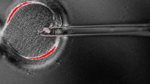 3-person IVF technique helps 8 babies to be born in U.K. to avoid rare diseases