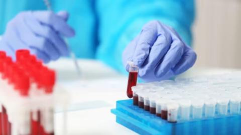 Canadian Blood Services plea for donations as supply drops 20% — below typical summer slump