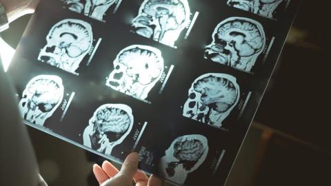 9 surprising habit changes that could prevent or delay dementia, according to Toronto experts