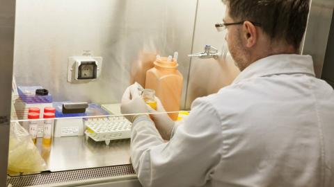 AI helps pathologists spot prostate cancer faster: What Canada can learn from landmark UK study
