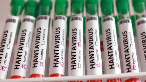 A third person in Ontario is now in isolation due to hantavirus exposure. Here's everything we know.