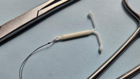 Advocates call for improved pain management for IUD insertions