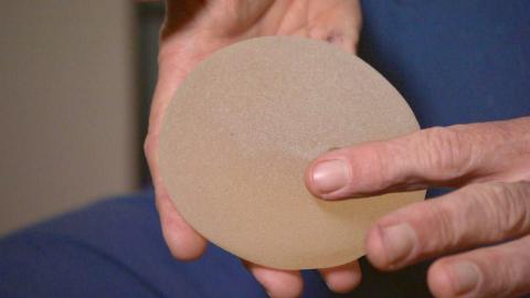 Advocates slam Health Canada's new voluntary breast implant registry