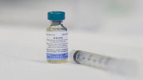 Alberta Health issues measles alert for Calgary