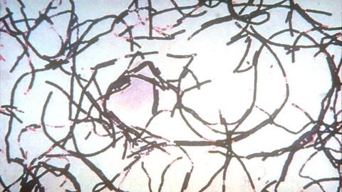 Anthrax outbreak kills more than 50 animals, infects 12 people in Zambia