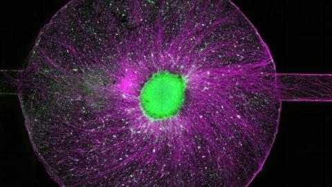 As brain organoids grow increasingly complex, leading scientists and bioethicists call for global oversight