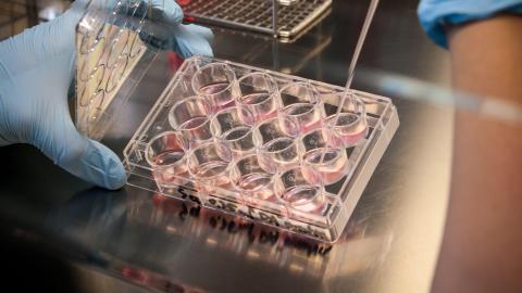 B.C. research 'opens the door' to more effective cancer therapies