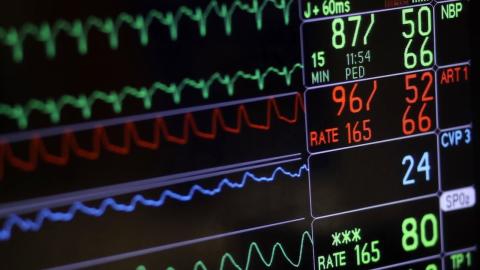 Blood thinners not needed for many with irregular heartbeat, says Canadian study