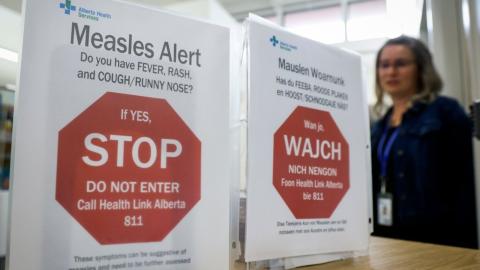 Calgary medical clinic site of potential measles exposure, province says - Calgary