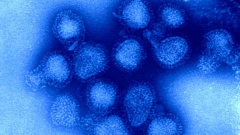 Canada could face 'worst kind' of flu season, experts warn