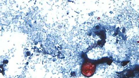Canada is not banning produce imports amid U.S. cyclosporiasis outbreak, CFIA says