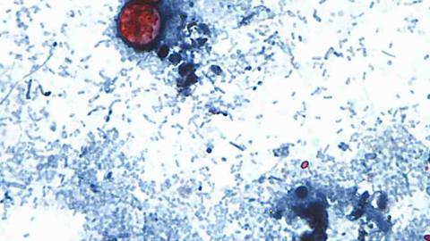 Canada warning travellers to U.S. of diarrhea-causing illness outbreak