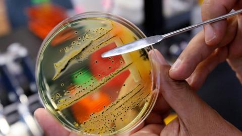 Canadian-led team of scientists discover new antibiotic hidden in decades-old bacterium