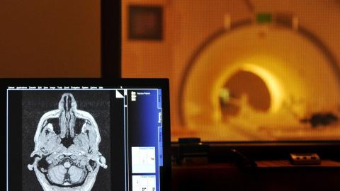 Cancer-diagnosed Albertans may have to partly pay for diagnostic scans, even after government compensation