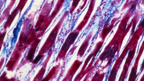 Cause of very rare Covid vaccine side effect, myocarditis, identified