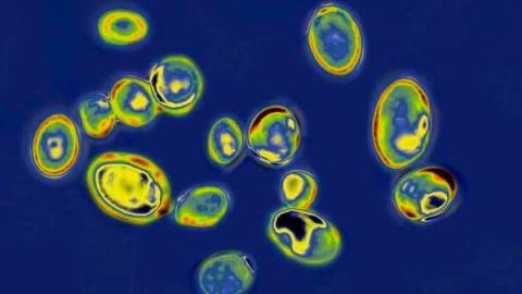 Dangerous, drug-resistant fungus spreads across N.Y., N.J. hospitals and nursing homes