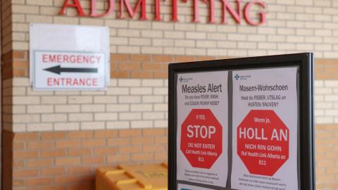 Death of premature Alberta baby with measles was not made public for months, documents show