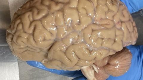 Doctors say there is a 25% chance a frozen brain or body could be revived in the future: survey