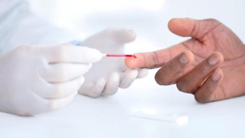 Earlier Cholesterol Testing Can Reduce Heart Attacks and Strokes, New Guideline Says