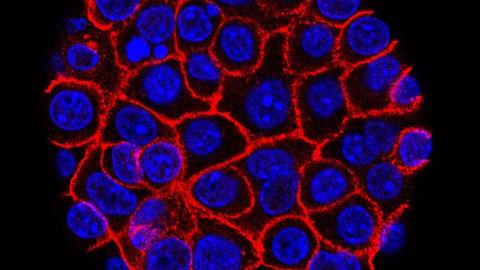 Experimental pill promises new hope for deadly pancreatic cancer