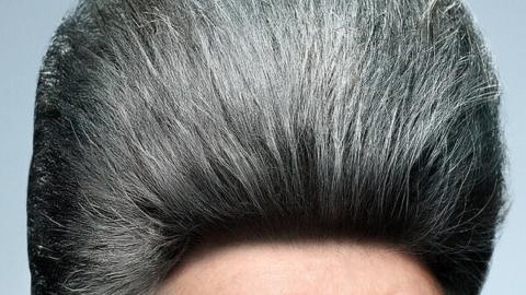 Finasteride for Male Baldness is Rewriting the Rules of Male Beauty