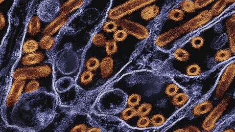 H5N1 detected in Texas dairy herd; researchers can't pinpoint source of California child's illness